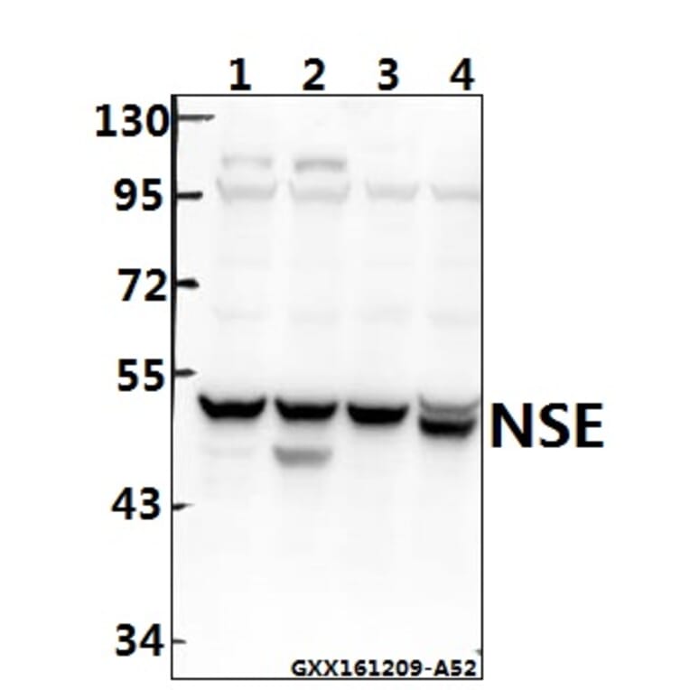 Anti-NSE/Enolase (R400) Antibody from Bioworld Technology (BS1259) - Antibodies.com