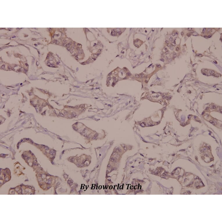 Anti-NSE/Enolase (R400) Antibody from Bioworld Technology (BS1259) - Antibodies.com