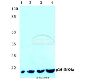 Anti-p16 INK4a (A20) Antibody from Bioworld Technology (BS1265) - Antibodies.com