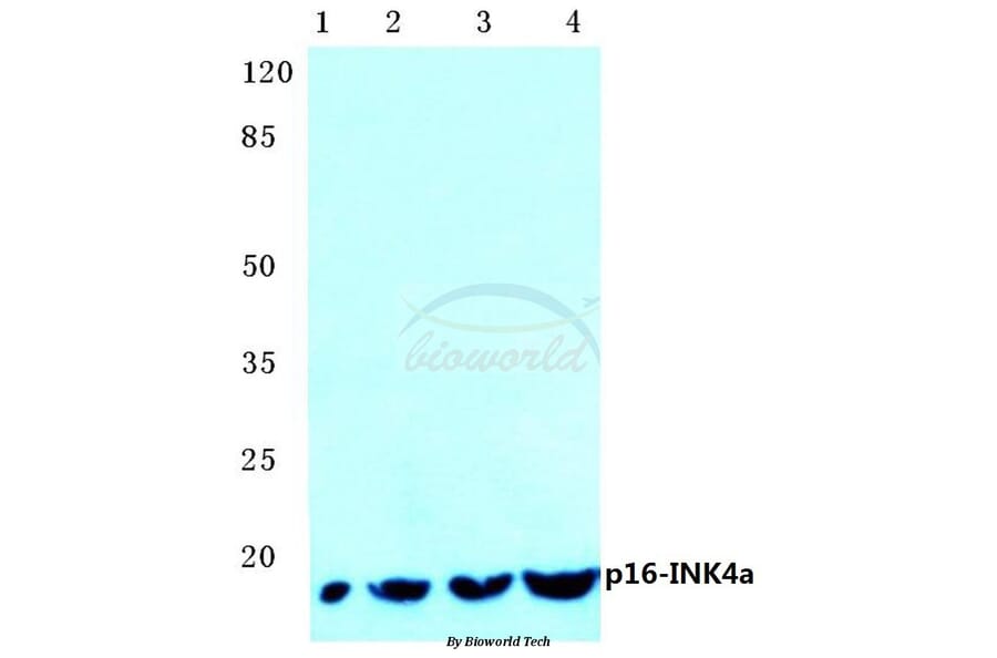 Anti-p16 INK4a (A20) Antibody from Bioworld Technology (BS1265) - Antibodies.com
