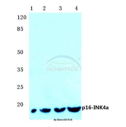 Anti-p16 INK4a (A20) Antibody from Bioworld Technology (BS1265) - Antibodies.com