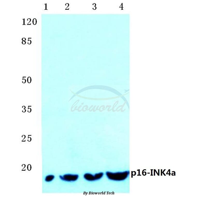 Anti-p16 INK4a (A20) Antibody from Bioworld Technology (BS1265) - Antibodies.com