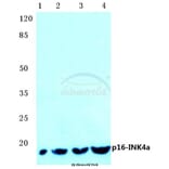 Anti-p16 INK4a (A20) Antibody from Bioworld Technology (BS1265) - Antibodies.com