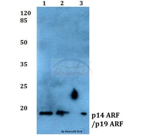 Anti-p14 ARF/p19 ARF (Q99) Antibody from Bioworld Technology (BS1266) - Antibodies.com