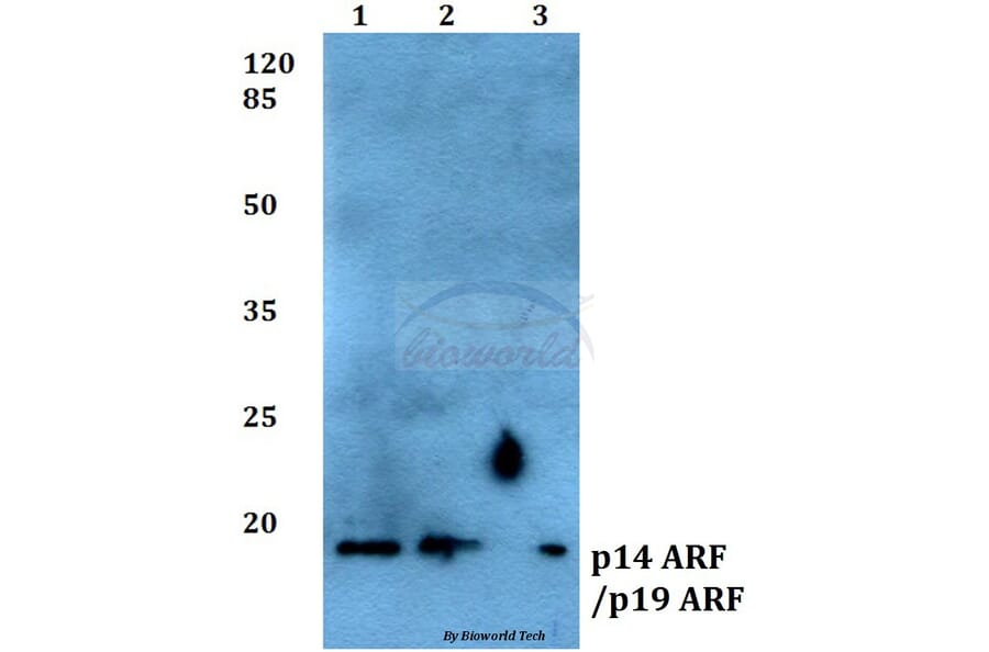 Anti-p14 ARF/p19 ARF (Q99) Antibody from Bioworld Technology (BS1266) - Antibodies.com