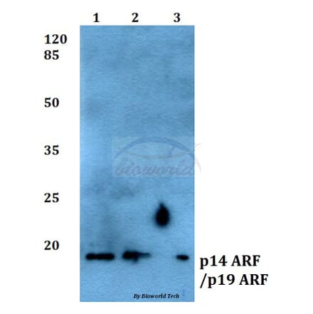 Anti-p14 ARF/p19 ARF (Q99) Antibody from Bioworld Technology (BS1266) - Antibodies.com