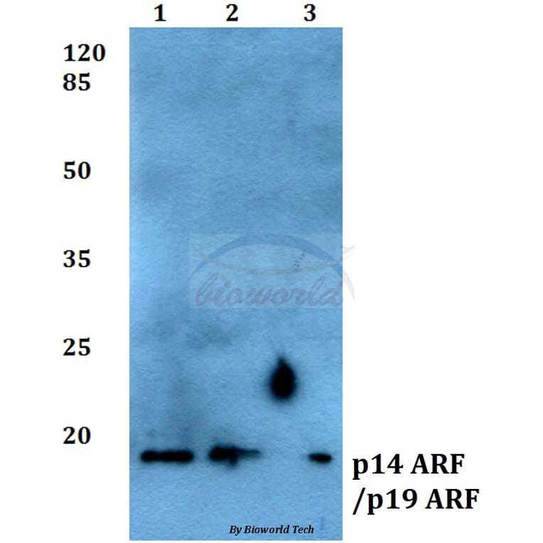 Anti-p14 ARF/p19 ARF (Q99) Antibody from Bioworld Technology (BS1266) - Antibodies.com