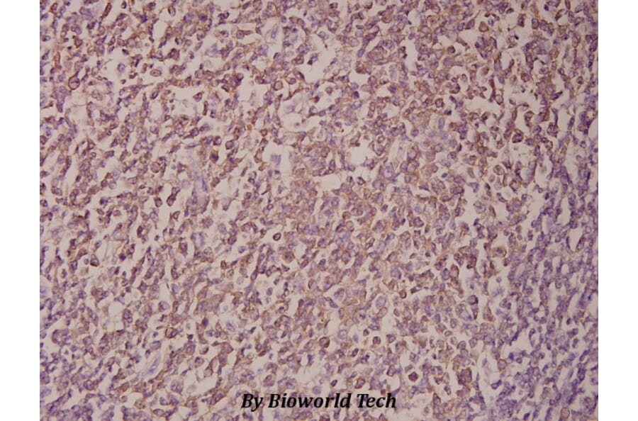 Anti-p14 ARF/p19 ARF (Q99) Antibody from Bioworld Technology (BS1266) - Antibodies.com