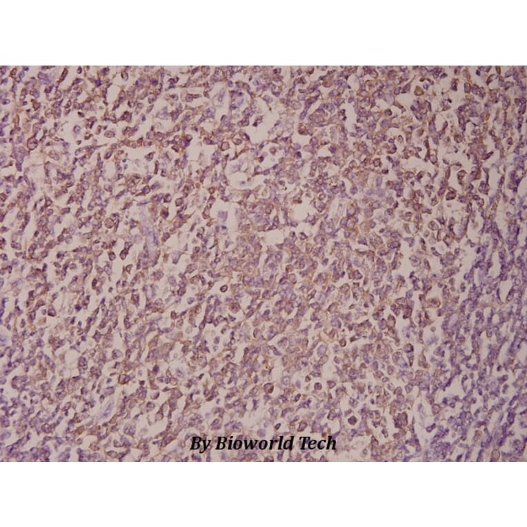 Anti-p14 ARF/p19 ARF (Q99) Antibody from Bioworld Technology (BS1266) - Antibodies.com