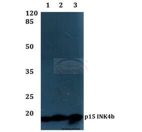 Anti-p15 INK4b (G113) Antibody from Bioworld Technology (BS1267) - Antibodies.com