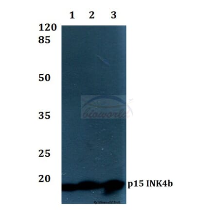 Anti-p15 INK4b (G113) Antibody from Bioworld Technology (BS1267) - Antibodies.com