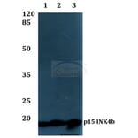 Anti-p15 INK4b (G113) Antibody from Bioworld Technology (BS1267) - Antibodies.com