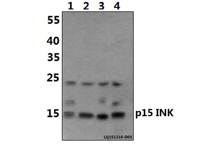 Anti-p15 INK4b (G113) Antibody from Bioworld Technology (BS1267) - Antibodies.com