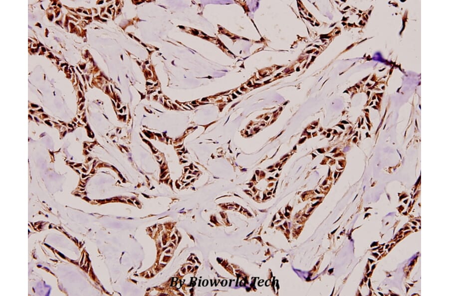 Anti-p15 INK4b (G113) Antibody from Bioworld Technology (BS1267) - Antibodies.com
