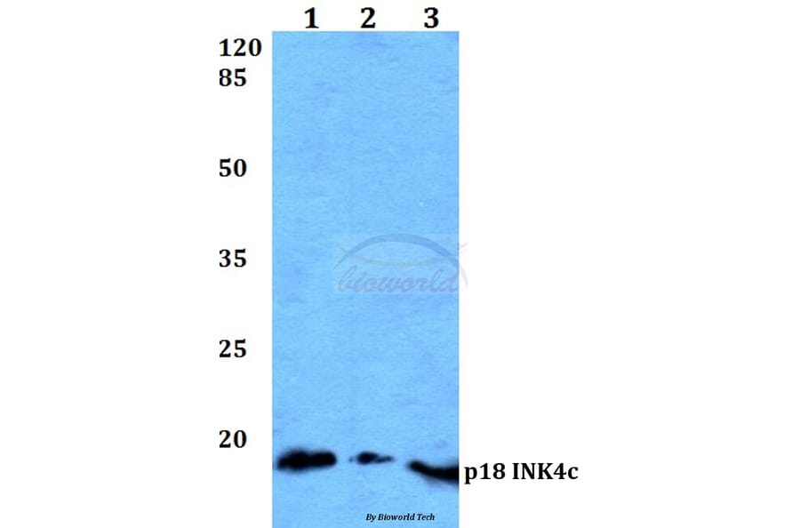 Anti-p18 INK4c (D142) Antibody from Bioworld Technology (BS1268) - Antibodies.com