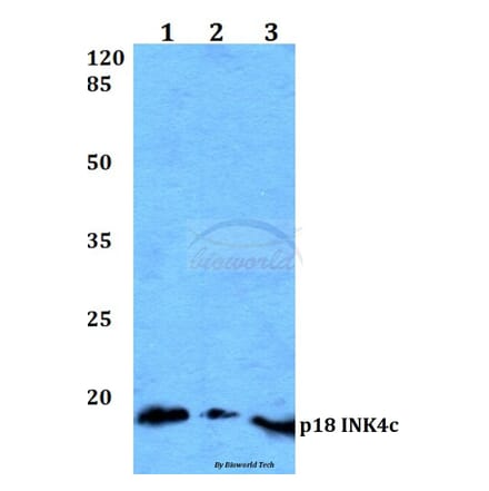 Anti-p18 INK4c (D142) Antibody from Bioworld Technology (BS1268) - Antibodies.com