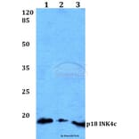 Anti-p18 INK4c (D142) Antibody from Bioworld Technology (BS1268) - Antibodies.com