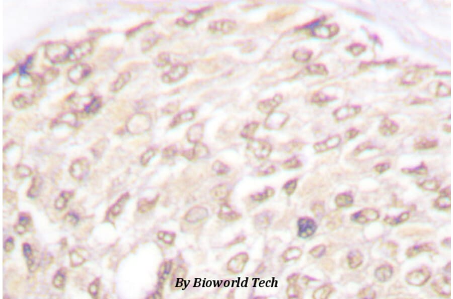 Anti-p18 INK4c (D142) Antibody from Bioworld Technology (BS1268) - Antibodies.com