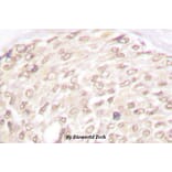 Anti-p18 INK4c (D142) Antibody from Bioworld Technology (BS1268) - Antibodies.com