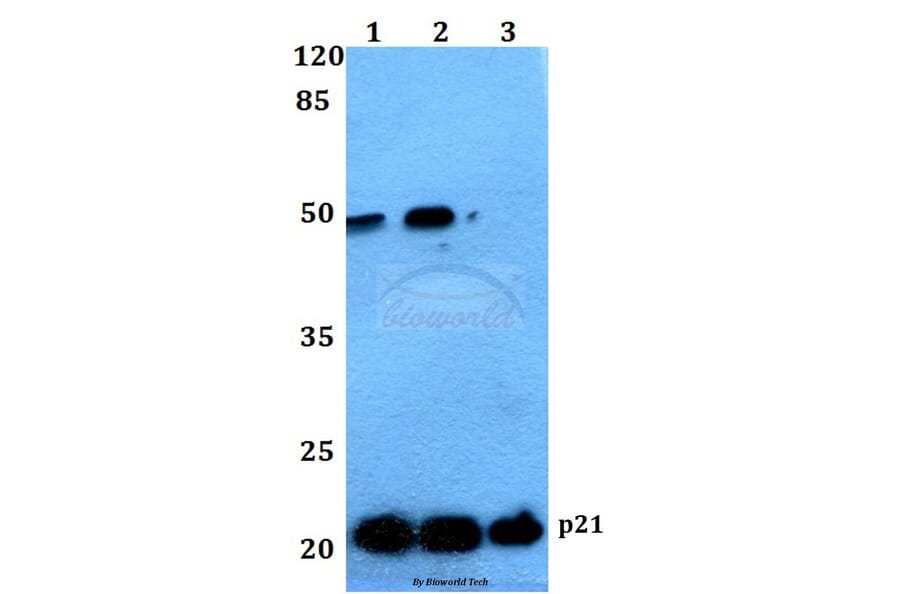 Anti-p21 (G139) Antibody from Bioworld Technology (BS1269) - Antibodies.com