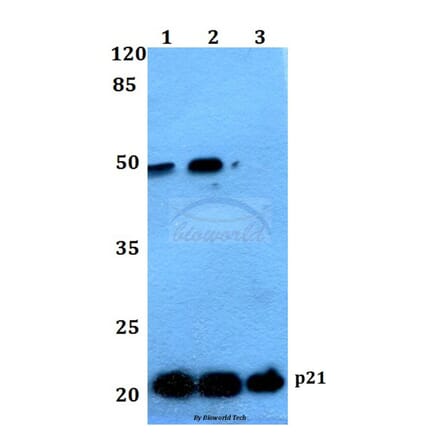 Anti-p21 (G139) Antibody from Bioworld Technology (BS1269) - Antibodies.com