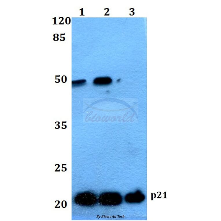 Anti-p21 (G139) Antibody from Bioworld Technology (BS1269) - Antibodies.com