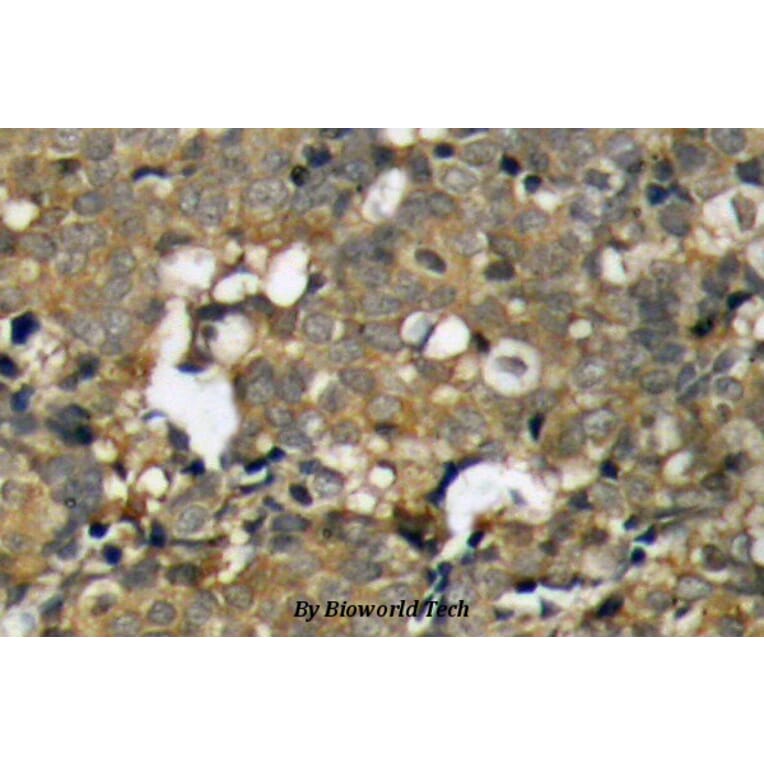 Anti-p21 (G139) Antibody from Bioworld Technology (BS1269) - Antibodies.com