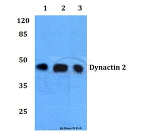 Anti-Dynactin 2 (L371) Antibody from Bioworld Technology (BS1271) - Antibodies.com