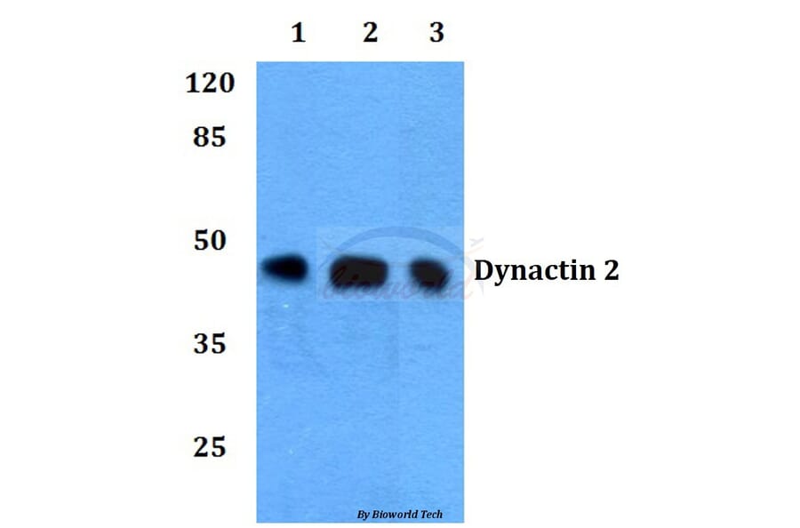 Anti-Dynactin 2 (L371) Antibody from Bioworld Technology (BS1271) - Antibodies.com