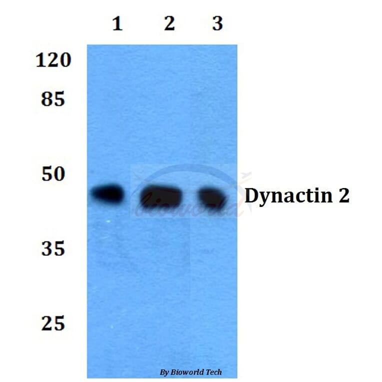 Anti-Dynactin 2 (L371) Antibody from Bioworld Technology (BS1271) - Antibodies.com