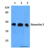 Anti-Dynactin 2 (L371) Antibody from Bioworld Technology (BS1271) - Antibodies.com