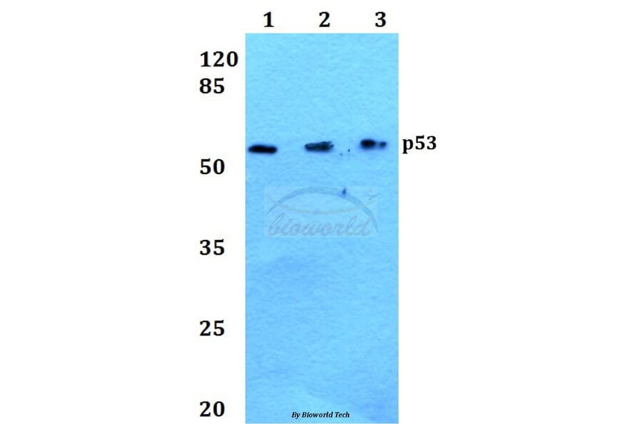 Anti-p53 (S9) Antibody from Bioworld Technology (BS1272) - Antibodies.com