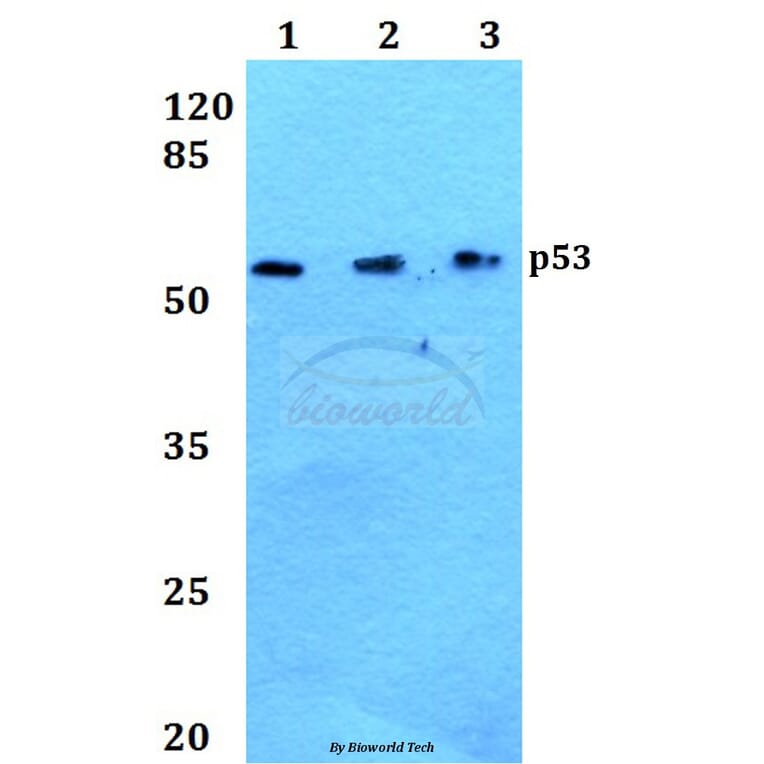 Anti-p53 (S9) Antibody from Bioworld Technology (BS1272) - Antibodies.com