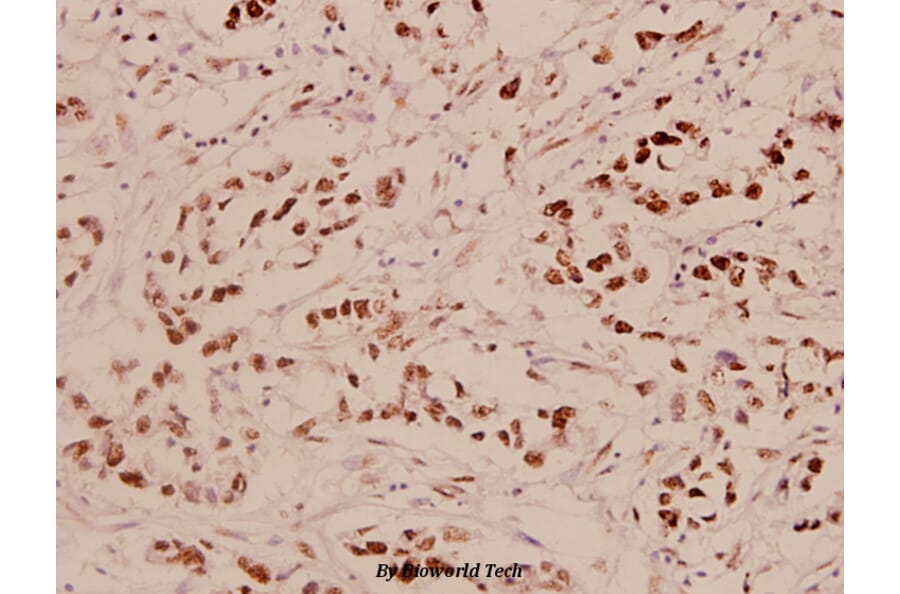 Anti-p53 (S9) Antibody from Bioworld Technology (BS1272) - Antibodies.com