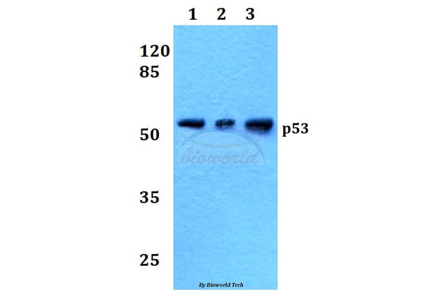 Anti-p53 (M40) Antibody from Bioworld Technology (BS1276) - Antibodies.com