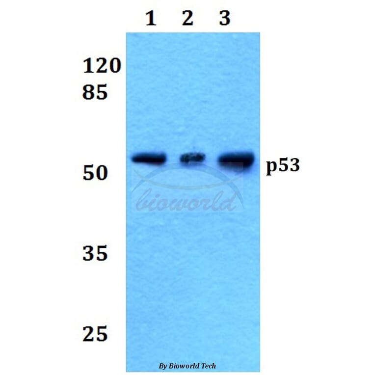Anti-p53 (M40) Antibody from Bioworld Technology (BS1276) - Antibodies.com