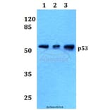 Anti-p53 (M40) Antibody from Bioworld Technology (BS1276) - Antibodies.com