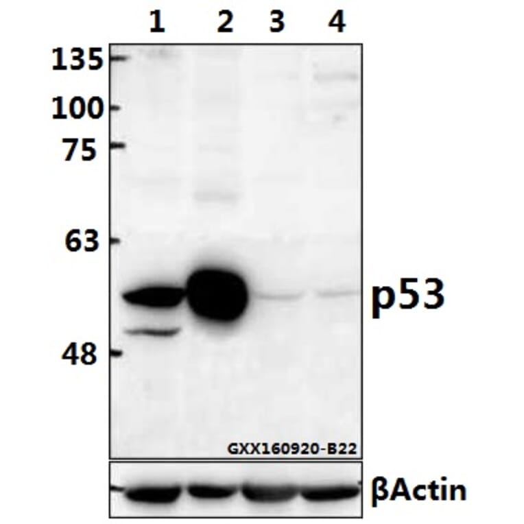 Anti-p53 (M40) Antibody from Bioworld Technology (BS1276) - Antibodies.com