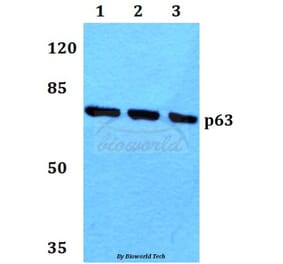 Anti-p63 (N662) Antibody from Bioworld Technology (BS1279) - Antibodies.com