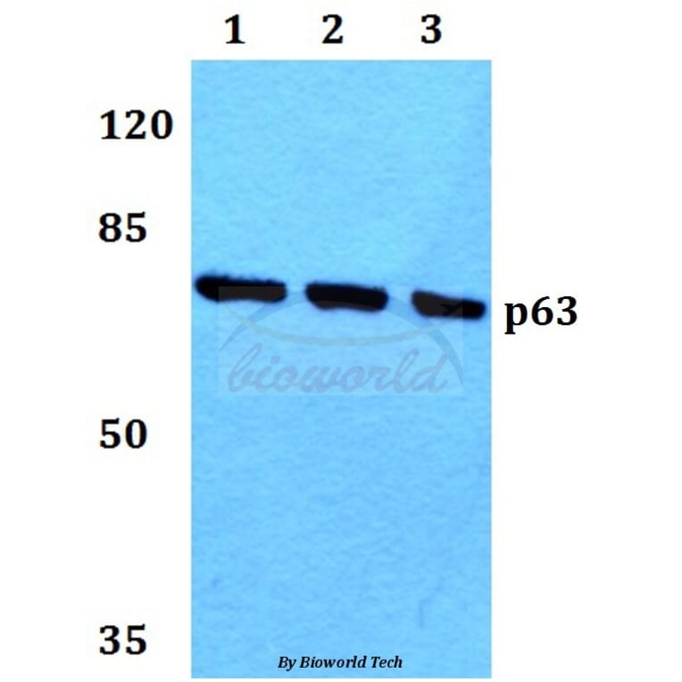 Anti-p63 (N662) Antibody from Bioworld Technology (BS1279) - Antibodies.com