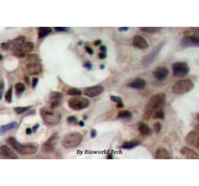 Anti-Nibrin (T337) Antibody from Bioworld Technology (BS1282) - Antibodies.com