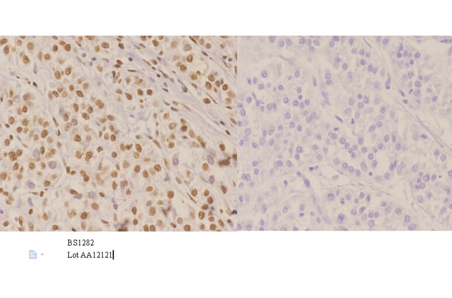 Anti-Nibrin (T337) Antibody from Bioworld Technology (BS1282) - Antibodies.com