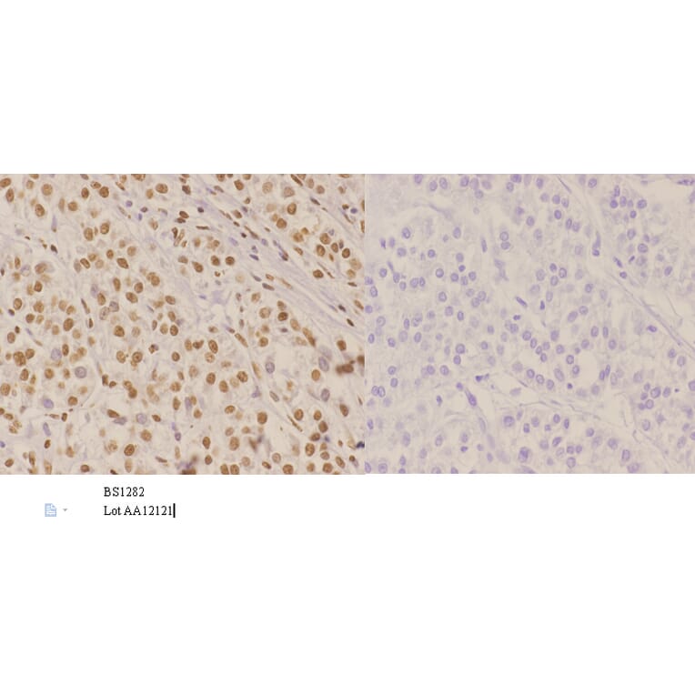 Anti-Nibrin (T337) Antibody from Bioworld Technology (BS1282) - Antibodies.com
