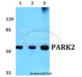 Anti-PARK2 (G12) Antibody from Bioworld Technology (BS1284) - Antibodies.com