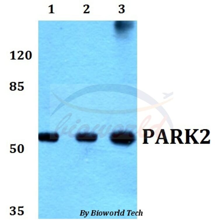 Anti-PARK2 (G12) Antibody from Bioworld Technology (BS1284) - Antibodies.com