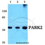 Anti-PARK2 (G12) Antibody from Bioworld Technology (BS1284) - Antibodies.com