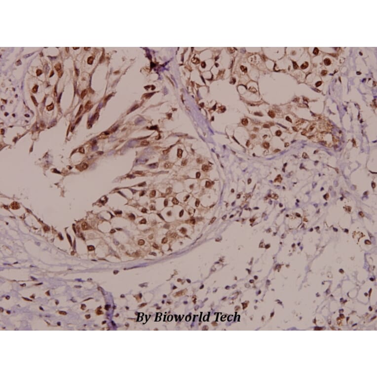 Anti-PARK2 (G12) Antibody from Bioworld Technology (BS1284) - Antibodies.com