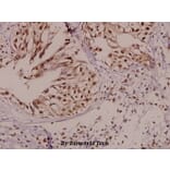 Anti-PARK2 (G12) Antibody from Bioworld Technology (BS1284) - Antibodies.com