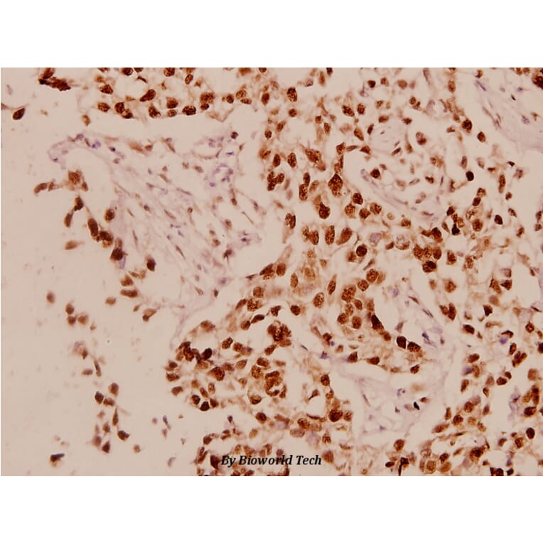 Anti-Cyclin L1 (E491) Antibody from Bioworld Technology (BS1285) - Antibodies.com