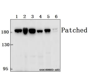 Anti-Patched (A2) Antibody from Bioworld Technology (BS1286) - Antibodies.com